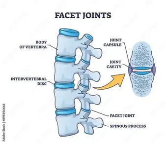 facet sindrom