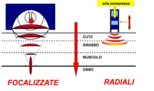 trattamento-urto-300x178