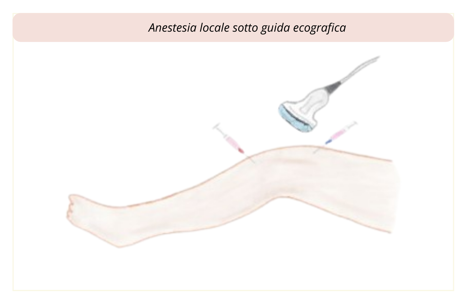 5) Anestesia locale ritaglio-1