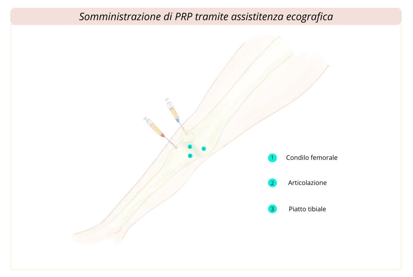 7) PRP ecoassistito ritagliato-2
