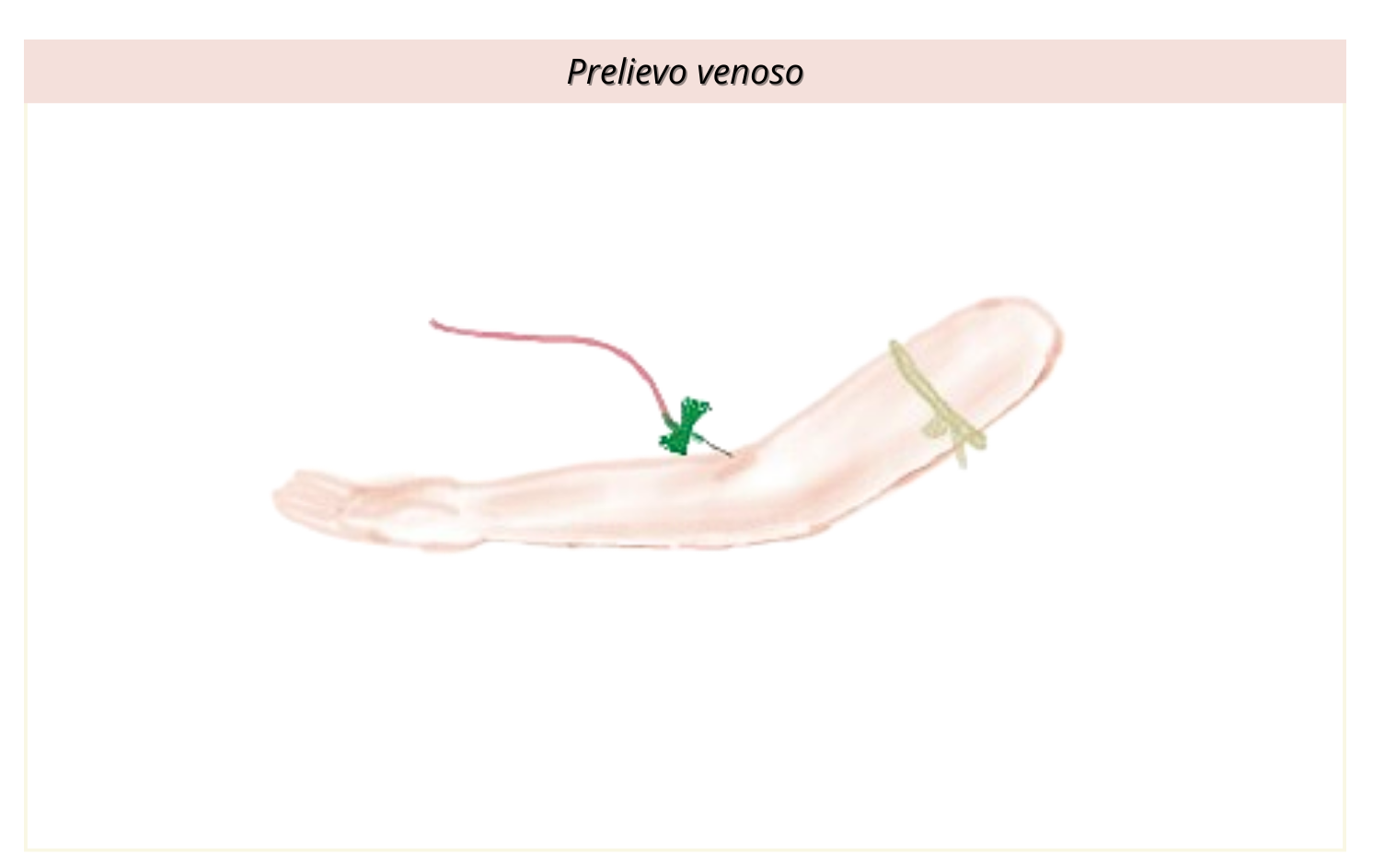Prelievo venoso defi