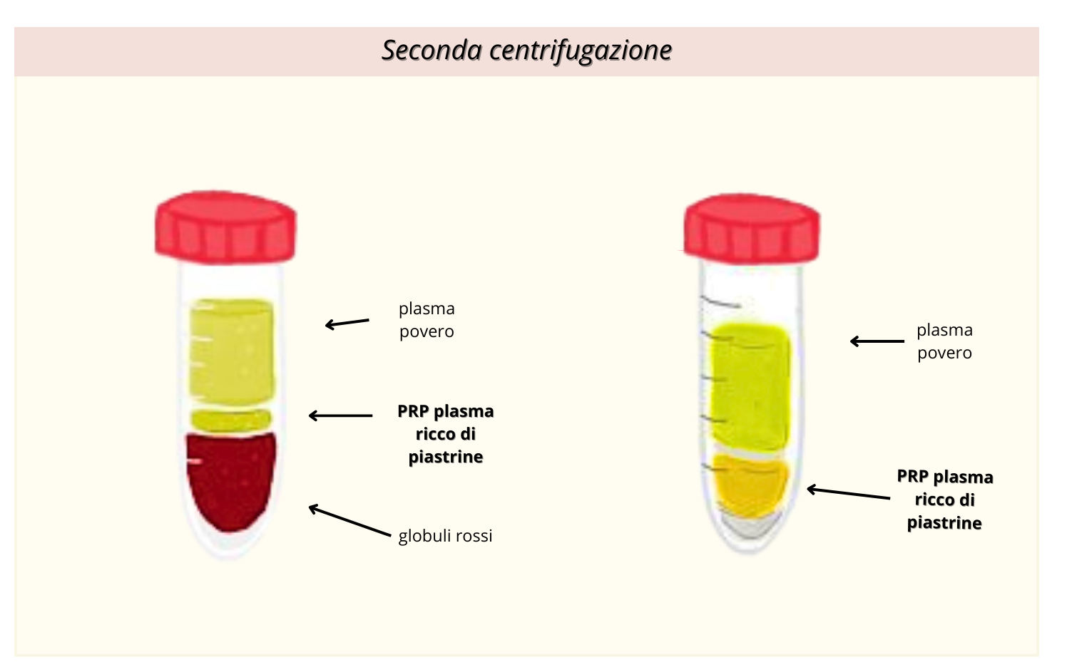 seconda centrifuga defi 