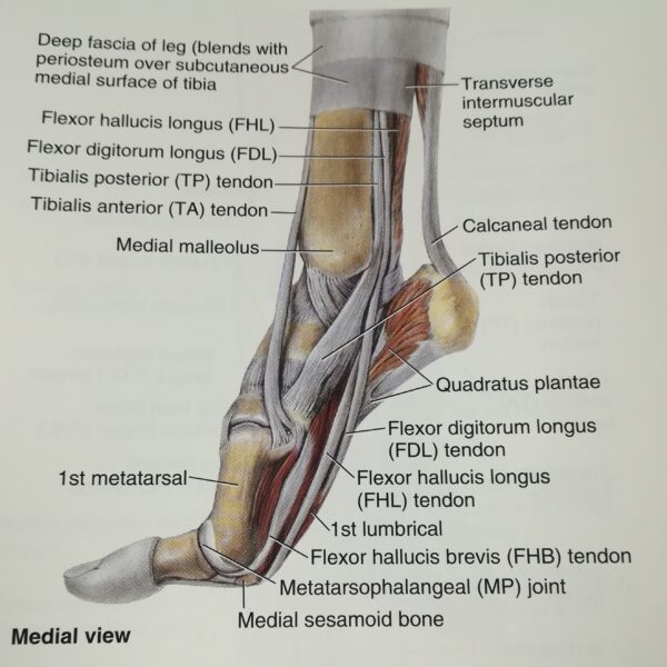 Caviglia artropatica da sovraccarico