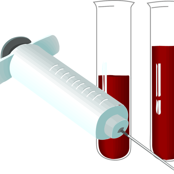 Come può il trattamento con PRP (plasma ricco in piastrine) può aiutarmi nel mio problema Muscoloscheletrico?